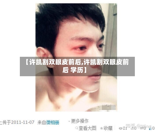 【许凯割双眼皮前后,许凯割双眼皮前后 学历】