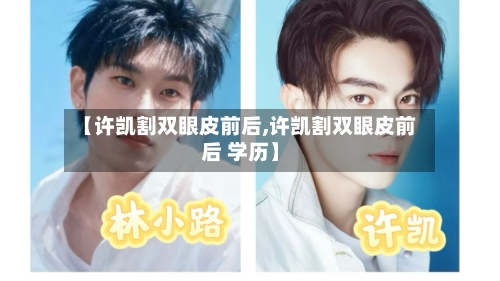 【许凯割双眼皮前后,许凯割双眼皮前后 学历】-第2张图片