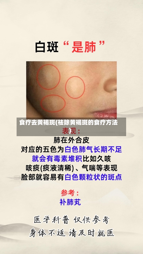 食疗去黄褐斑(祛除黄褐斑的食疗方法)