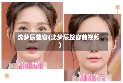 沈梦辰整容(沈梦辰整容前视频)-第2张图片