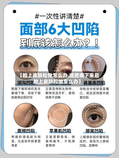 【脸上皮肤松弛怎么办,减肥瘦下来后脸上皮肤松弛怎么办】